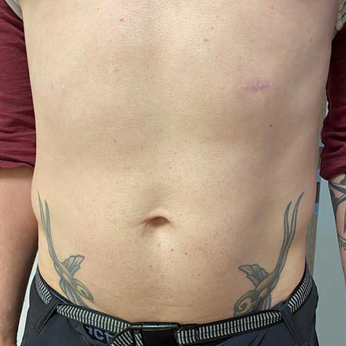 sichtbare Erfolge mit dem BODYformer erzielen