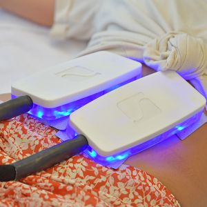 Cryo-Kälteplattenanwendung in deinem FIGURline Figurstudio und Beautystudio Hannover